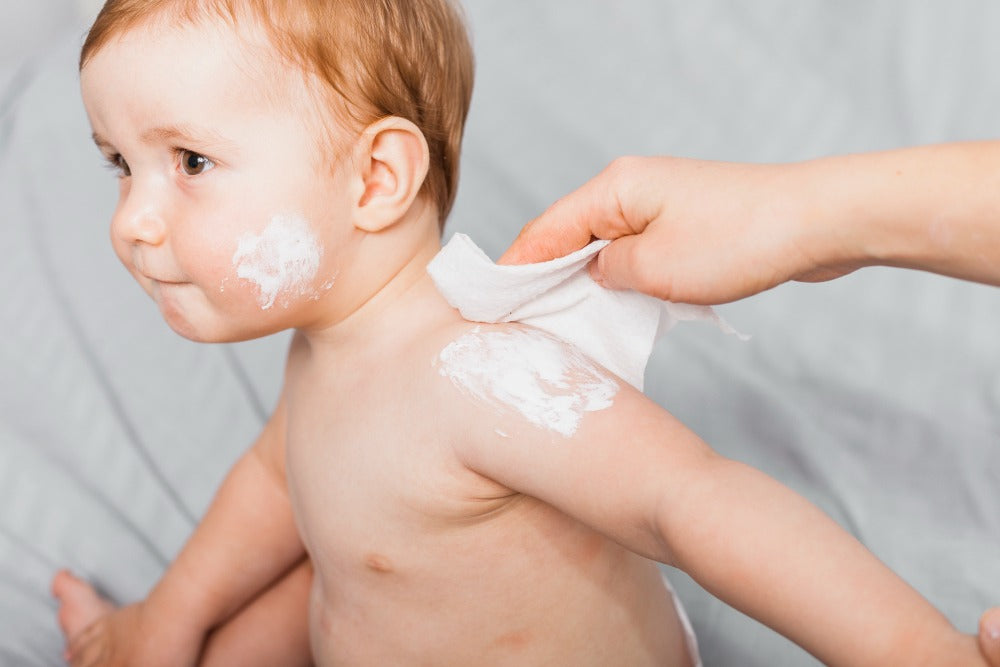 Baby Eczema: Natural Treatments, Trigger Foods & Why Your Diaper Choice Matters More Than You Think