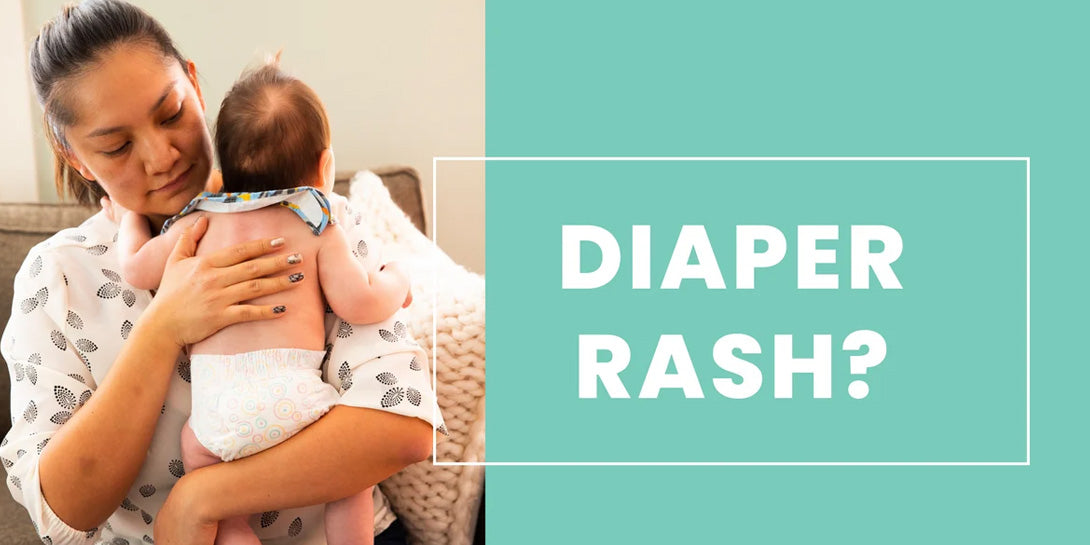 How Choosing the Right Diaper Prevents Diaper Rash